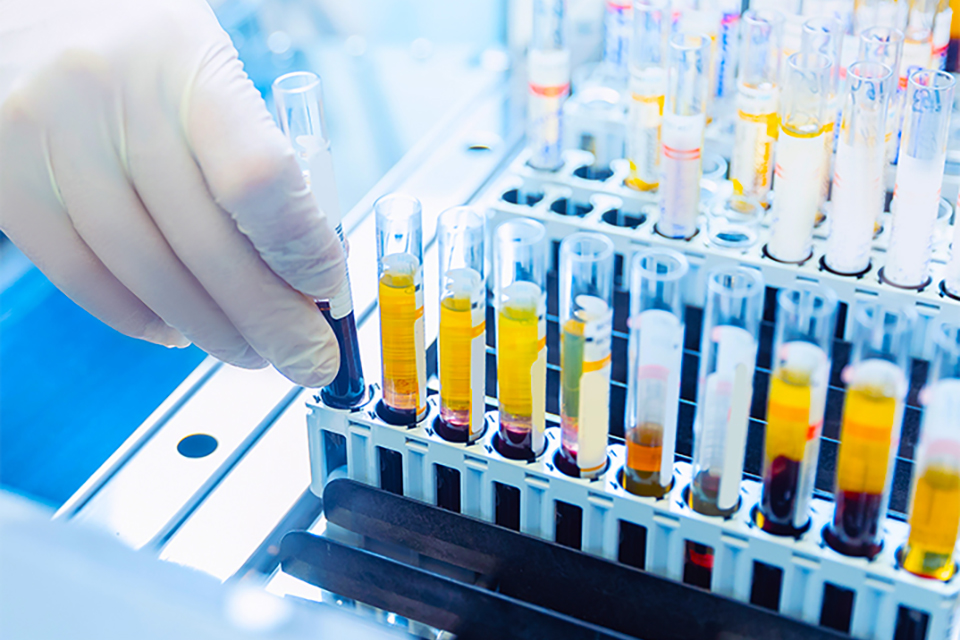 Workplace Drug Testing and Cannabis Legalization